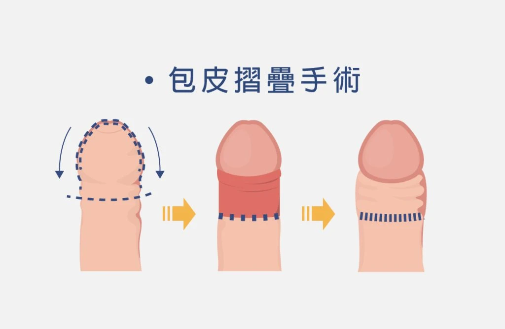 長短大小真的重要嗎?如何增粗?