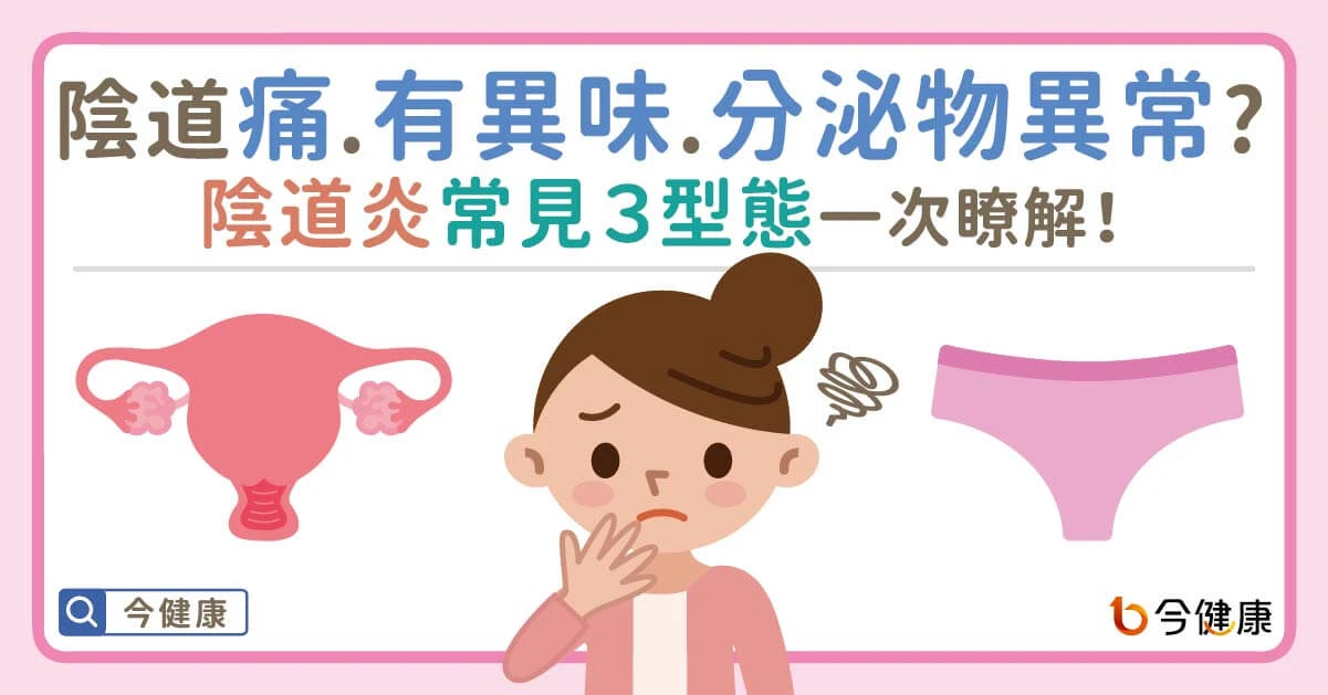 陰道炎常見症狀示意圖