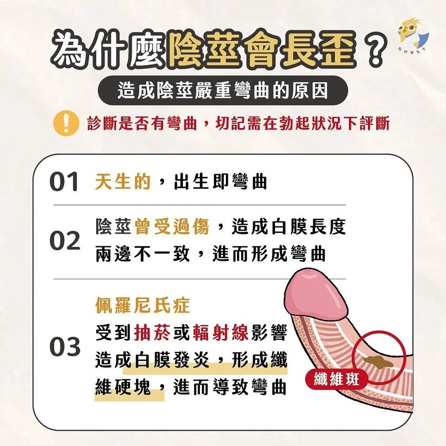 陰莖檢查示意圖
