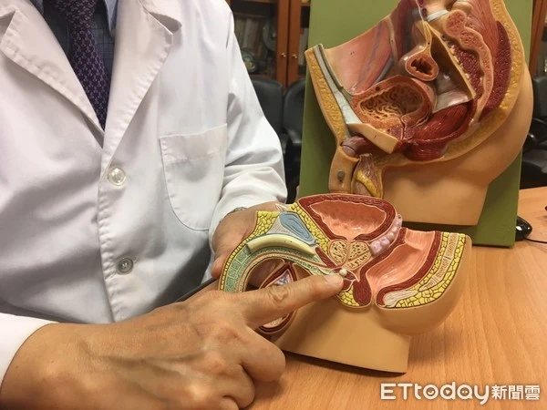 攝護腺為男性特有的腺體。