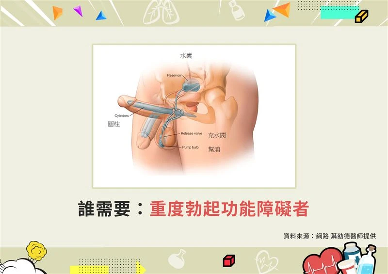陽痿最愛找5種人？葉劭德醫師揭秘男人10大酷刑手術，告別勃起障礙重拾性福